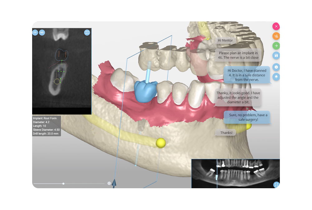 SMART Guide Surgical Planner